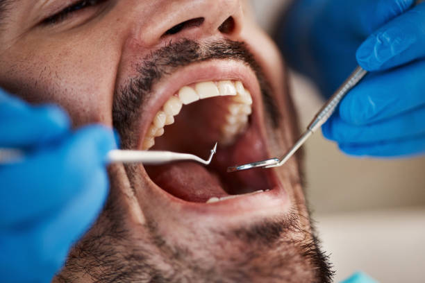 Best Emergency Treatment for Dental Infections or Abscesses in Enon, OH